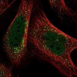 PIGQ Polyclonal Antibody:Antibodies, Polyclonal