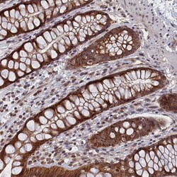 PIGQ Polyclonal Antibody:Antibodies, Polyclonal