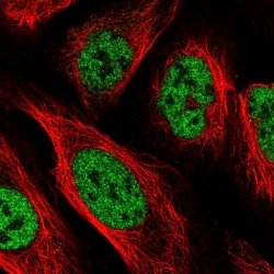 Invitrogen PPP4R2 Polyclonal Antibody 100 &mu;L; Unconjugated:Antibodies,