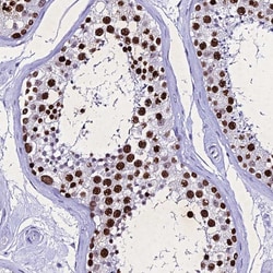 Invitrogen PPP4R2 Polyclonal Antibody 100 &mu;L; Unconjugated:Antibodies,