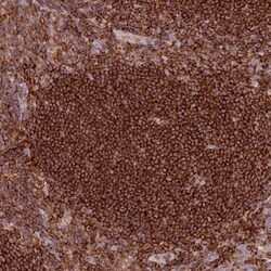 Invitrogen SIPA1 Polyclonal Antibody 100 &mu;L; Unconjugated:Antibodies,