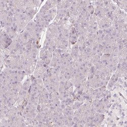 Invitrogen SIPA1 Polyclonal Antibody 100 &mu;L; Unconjugated:Antibodies,