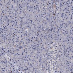 RhoG Polyclonal Antibody:Antibodies, Polyclonal