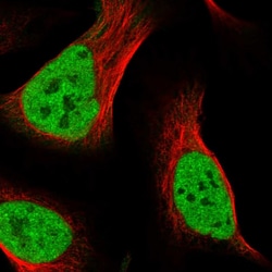 Invitrogen SECISBP2L Polyclonal Antibody 100 &mu;L; Unconjugated:Antibodies,