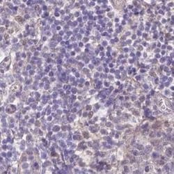 Invitrogen NXPE2 Polyclonal Antibody 100 &mu;L; Unconjugated:Antibodies,