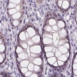 Invitrogen NXPE2 Polyclonal Antibody 100 &mu;L; Unconjugated:Antibodies,