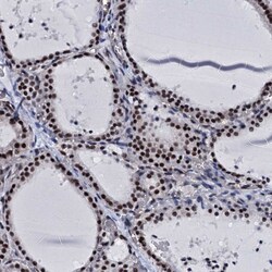 Invitrogen CWC15 Polyclonal Antibody 100 &mu;L; Unconjugated:Antibodies,