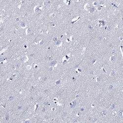Invitrogen TMEM72 Polyclonal Antibody 100 &mu;L; Unconjugated:Antibodies,