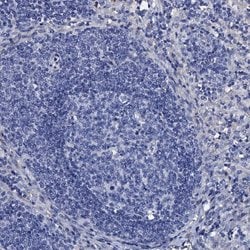 Invitrogen TMEM72 Polyclonal Antibody 100 &mu;L; Unconjugated:Antibodies,