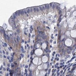Invitrogen TMEM72 Polyclonal Antibody 100 &mu;L; Unconjugated:Antibodies,