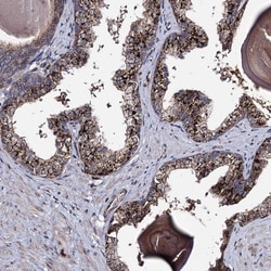 MICALCL Polyclonal Antibody:Antibodies, Polyclonal