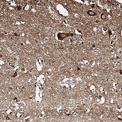 Invitrogen NDUFA12 Polyclonal Antibody 100 &mu;L; Unconjugated:Antibodies,