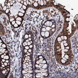 Invitrogen NDUFA12 Polyclonal Antibody 100 &mu;L; Unconjugated:Antibodies,