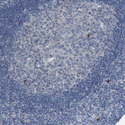 Invitrogen GIF Polyclonal Antibody 100 &mu;L; Unconjugated:Antibodies,