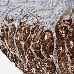 Invitrogen GIF Polyclonal Antibody 100 &mu;L; Unconjugated:Antibodies,