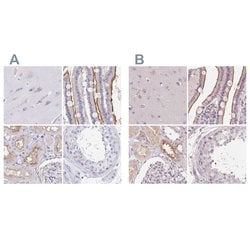 Invitrogen TREH Polyclonal Antibody 100 &mu;L; Unconjugated:Anticuerpos