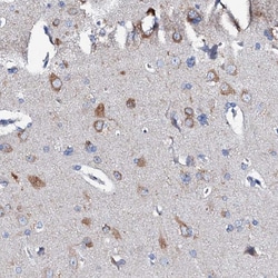GLB1L3 Polyclonal Antibody:Antibodies, Polyclonal