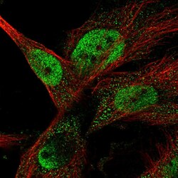 Invitrogen ANKRD42 Polyclonal Antibody 100 &mu;L; Unconjugated:Antibodies,