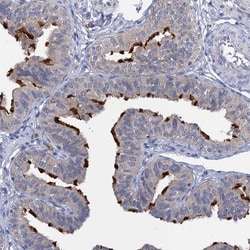 Invitrogen ANKRD42 Polyclonal Antibody 100 &mu;L; Unconjugated:Antibodies,