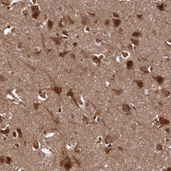 Invitrogen PIGN Polyclonal Antibody 100 &mu;L | Buy Online | Invitrogen&trade; | Fisher Scientific