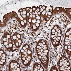 Invitrogen PIGN Polyclonal Antibody 100 &mu;L | Buy Online | Invitrogen&trade; | Fisher Scientific