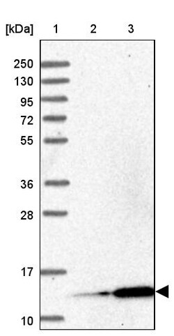 Invitrogen MRPL51 Polyclonal Antibody 100 &mu;L | Buy Online | Invitrogen&trade; | Fisher Scientific