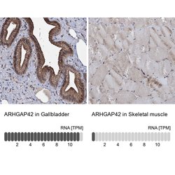 Invitrogen ARHGAP42 Polyclonal Antibody 100 &mu;L; Unconjugated:Antibodies,