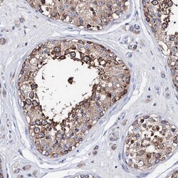 Invitrogen ATP8A2 Polyclonal Antibody 100 &mu;L; Unconjugated:Antibodies,