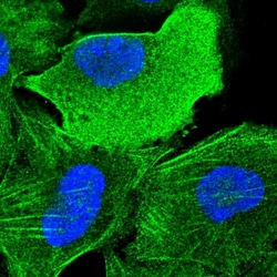 Invitrogen SLC46A3 Polyclonal Antibody 100 &mu;L | Buy Online | Invitrogen&trade; | Fisher Scientific