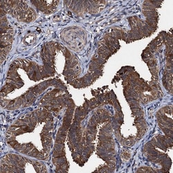 Invitrogen SLC46A3 Polyclonal Antibody 100 &mu;L | Buy Online | Invitrogen&trade; | Fisher Scientific