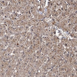Invitrogen SLC46A3 Polyclonal Antibody 100 &mu;L | Buy Online | Invitrogen&trade; | Fisher Scientific