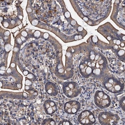 Invitrogen SLC46A3 Polyclonal Antibody 100 &mu;L | Buy Online | Invitrogen&trade; | Fisher Scientific
