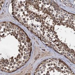 Invitrogen SLC46A3 Polyclonal Antibody 100 &mu;L | Buy Online | Invitrogen&trade; | Fisher Scientific