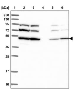 Invitrogen SLC46A3 Polyclonal Antibody 100 &mu;L | Buy Online | Invitrogen&trade; | Fisher Scientific