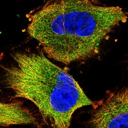 NDUFAF1 Polyclonal Antibody:Antibodies, Polyclonal