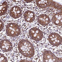 NDUFAF1 Polyclonal Antibody:Antibodies, Polyclonal