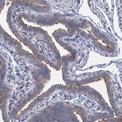 Invitrogen LRTOMT Polyclonal Antibody 100 &mu;L; Unconjugated:Antibodies,