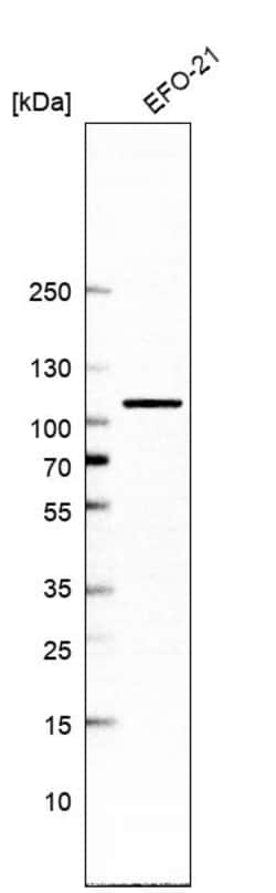 Invitrogen TBCK Polyclonal Antibody 100 &mu;L; Unconjugated:Antibodies,