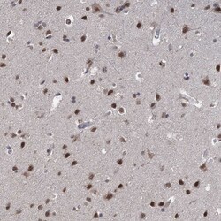 Invitrogen FANCI Polyclonal Antibody 100 &mu;L; Unconjugated:Antibodies,