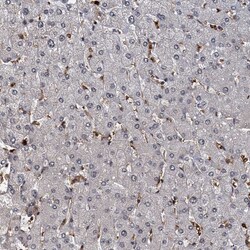 Invitrogen FANCI Polyclonal Antibody 100 &mu;L; Unconjugated:Antibodies,