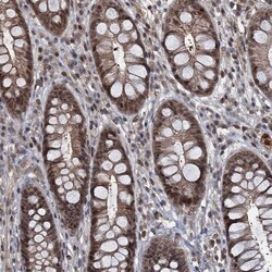 Invitrogen FANCI Polyclonal Antibody 100 &mu;L; Unconjugated:Antibodies,