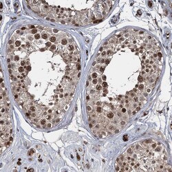 Invitrogen FANCI Polyclonal Antibody 100 &mu;L; Unconjugated:Antibodies,