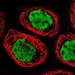 Invitrogen CPSF6 Polyclonal Antibody 100 &mu;L; Unconjugated:Antibodies,