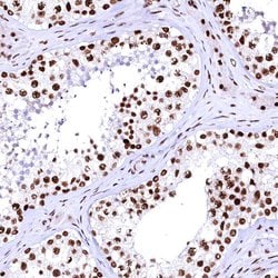 Invitrogen CPSF6 Polyclonal Antibody 100 &mu;L; Unconjugated:Antibodies,