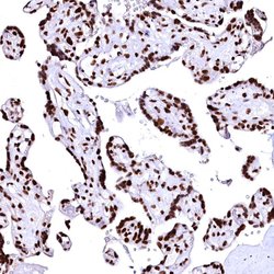 Invitrogen CPSF6 Polyclonal Antibody 100 &mu;L; Unconjugated:Antibodies,