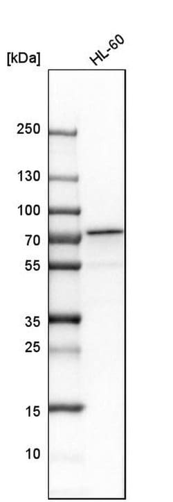 Invitrogen CPSF6 Polyclonal Antibody 100 &mu;L; Unconjugated:Antibodies,