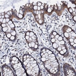 Invitrogen GPR176 Polyclonal Antibody 100 &mu;L; Unconjugated:Antibodies,