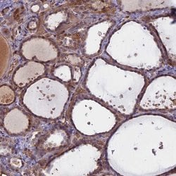 Invitrogen UFSP2 Polyclonal Antibody 100 &mu;L; Unconjugated:Antibodies,