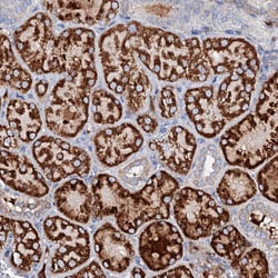 Invitrogen SLC10A7 Polyclonal Antibody 100 &mu;L; Unconjugated:Antibodies,