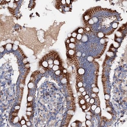 Invitrogen SLC10A7 Polyclonal Antibody 100 &mu;L; Unconjugated:Antibodies,